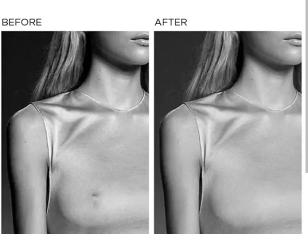 Nipple-Covers